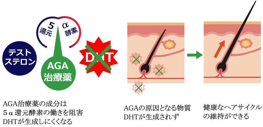AGA治療薬作用機序